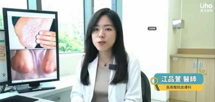 一家之主因乾癬問題險丟工作!乾癬不只疾病,身心壓力帶來的「累積生命損傷」更需高度關注