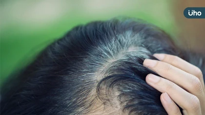 白髮長不停好苦惱 中醫改善氣血變烏髮