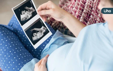 雙胞胎「相隔111天出生」創紀錄!醫揭罕見「延遲生產」安胎關鍵