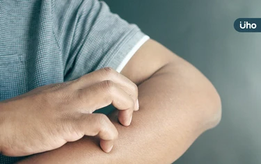 乾燥症是什麼?有哪些症狀?解析原因、症狀、治療方式:是重大傷病