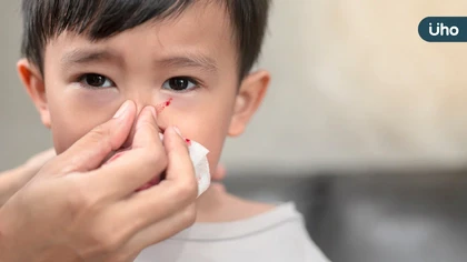 天冷易流鼻血 戴口罩有奇效