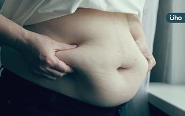 脂肪肝竟能抑制B肝病毒?台大研究意外揭「輕度脂肪肝可降死亡率」