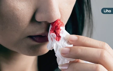 為什麼會流鼻血？流鼻血是癌症前兆嗎？小心「5大疾病」都會鼻出血