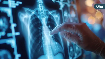 盼健保予存活希望!無腫瘤基因突變肺腺癌病患喊話:給付免疫藥物合併標準化療