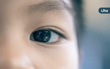 感冒沒全好⋯眼睛竟惡化成蜂窩性組織炎？醫揭「1危險後遺症」恐失明