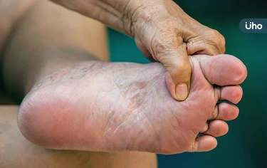 為什麼會糖尿病足潰瘍？醫示警「4大狀況」要小心：亂剪指甲也上榜