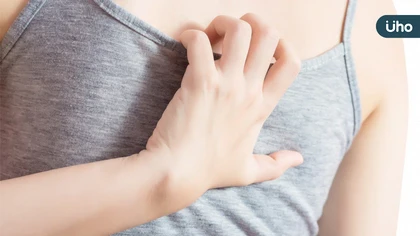 乾癬竟致親密關係受損?醫:及早治療助解決