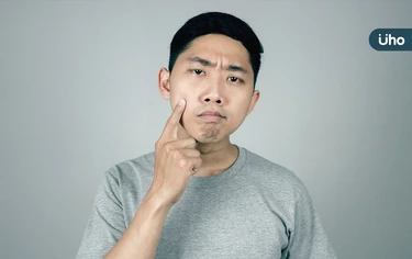 肝不好，看臉就知道？醫揭肝病「4大跡象」：膚色變黃、身上長紅痣