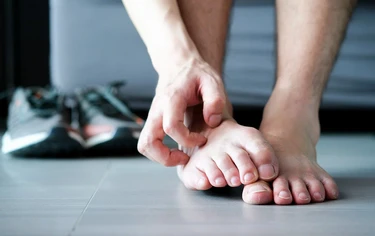 哪些人容易得香港腳？皮膚科醫列「5大黴菌感染源」這種腳型易感染