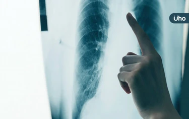 年省150萬藥費！石崇良：健保擴大給付「晚期肺癌」2000人受惠