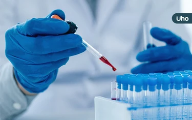 鉛中毒檢測大突破!長庚、北科大研發「檢驗晶片」1滴血10分鐘測鉛毒