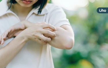 超慢跑也可治皮膚問題？中醫教「4招日常調理」改善反覆紅疹、皮膚癢