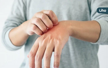 老翁夜間搔癢竟抓出「千蟲鑽動」！醫警告「結痂型疥瘡」恐感染全家