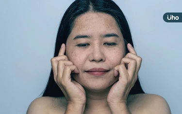 火雞脖、蠟融臉⋯快速瘦身恐害皮膚垮!營養師教「3招」吃對餐食比例
