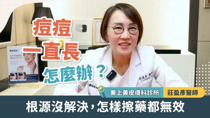 痘痘一直長怎麼辦?痘疤女王莊盈彥醫師:根源沒解決 怎樣擦藥都無效