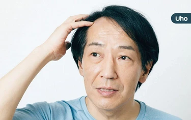 掉髮是洗髮精用錯？壓力禿會自己長回來？醫揭5大迷思：恐疾病警訊