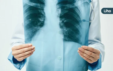  6成肺癌患者沒抽菸習慣！肺癌權威揭「3件事」才是降低死亡率關鍵