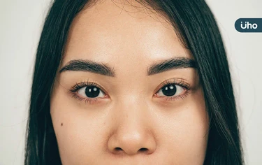 小人痣、福氣痣⋯你的臉上長哪些痣？一文看懂「5種痣」辨別吉凶徵兆