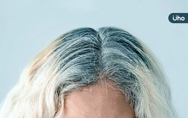 壓力大真的會長白頭髮！醫教「1招」白髮變黑髮：試著說出內心感受