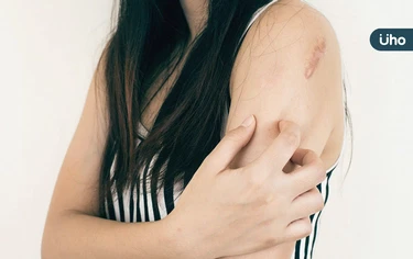 皮膚搔癢難耐、抓到流血⋯皮膚科醫授「抗癢5招」緩解異位性皮膚炎