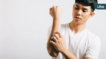 卸下長袖,告別脫皮人生!醫:穩控乾癬避免引發關節炎,及早治療守住生活品質