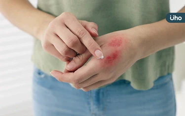 皮膚有傷口怎麼辦？如何讓傷口快速癒合？醫教「急性VS慢性」傷口照護