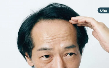 變胖、禿頭⋯好怕旁人嘲笑眼光！心理師教你「2方法」看穿容貌焦慮