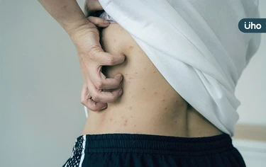 冬季癢靠清潔能改善？醫揭「3大壞習慣」越洗越乾：洗澡洗太久也算