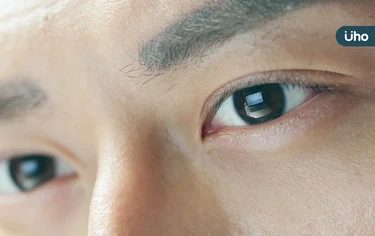 視力模糊、線條扭曲⋯不只是用眼過度！醫曝恐「這部位老化」長皺褶