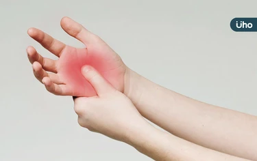 這不是板機指！手張不開、手腕長腫塊⋯醫揭「掌腱膜攣縮症」1特徵