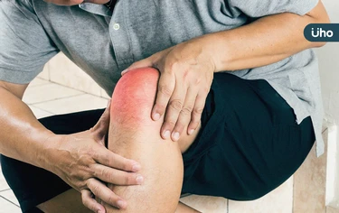 膝腫痛以為退化性關節炎？檢查竟是「骨結核病變」！醫：膝蓋痛別拖