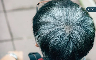 曬太陽容易長白頭髮？日本專家列頭皮保養法：防曬乳挑選「這1種」