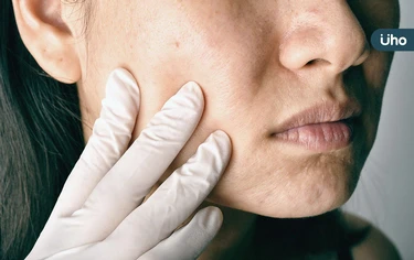 重鹹重口味，臉腫成豬頭？營養師教「3大減鈉技巧」這樣吃輕鬆消水腫