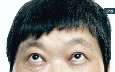 視力模糊、眼前黑點⋯醫列「糖尿病眼病變」3警訊:恐成中年失明主因