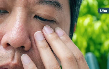 35歲就患白內障！醫曝「年輕型白內障」患者暴增：當心3大警訊症狀