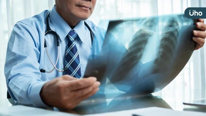 50歲男肺癌連葉克膜都用上!免疫治療+抗血管新生合併化療穩病情