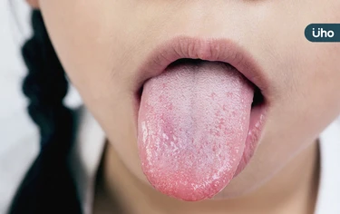 舌苔黃正常嗎？需要每天刷？「黃、灰黑、厚白⋯」8種舌象自我檢測