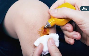 傷口飄出「臭雞蛋味」別輕忽！醫示警「感染已很嚴重」需評估1治療