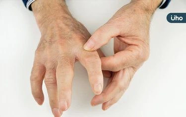 手指腫脹、僵硬⋯當心類風溼性關節炎！中醫教「2招保健」冷熱敷舒緩