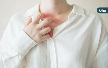 皮膚癢到睡不著，竟不是過敏引起？醫揪「慢性自發性蕁麻疹」1元凶