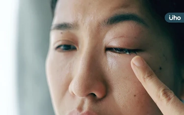 眼睛乾澀、有異物感⋯恐是自體免疫疾病前兆！醫：伴隨「2症狀」當心