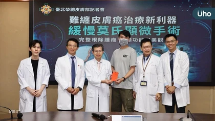 難纏皮膚癌治療新利器：緩慢莫氏顯微手術 完整根除腫瘤 兼顧功能與美觀