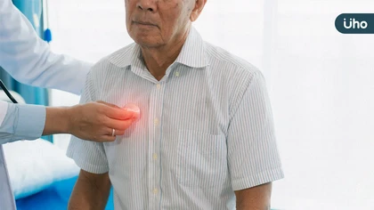 小細胞肺癌突破長期存活困境!一線免疫合併化療帶來7年存活曙光