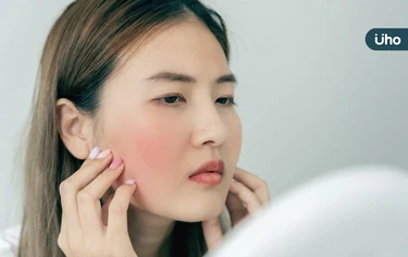 紅斑性狼瘡是重大傷病嗎？有哪些症狀？會痊癒嗎？常見迷思一次瞭解
