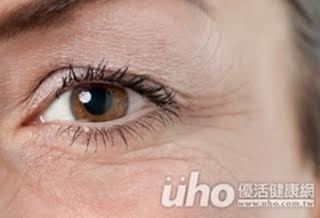 每年流失1%的緊緻度 肌膚老化一發不可收拾