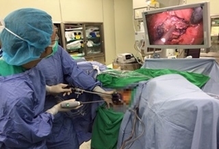 低位腸癌需切肛?新式手術保留排便功能