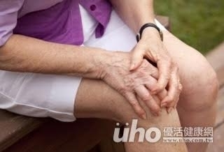 當心!乾癬不只會癢 3成患者併發關節炎