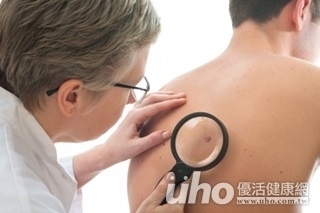 妙齡女指甲長黑線 竟是致命黑色素癌上身