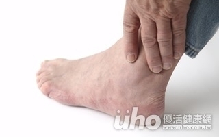 他尾牙吃到腳腫 亂服降尿酸藥竟全身紅疹