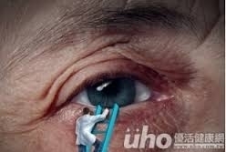 老婦糖尿病控制差 黃斑部水腫險失明
